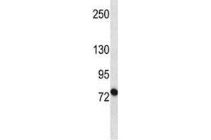 Western Blotting (WB) image for anti-ATP-Binding Cassette, Sub-Family B (MDR/TAP), Member 10 (ABCB10) (AA 1-27) antibody (ABIN3030047)