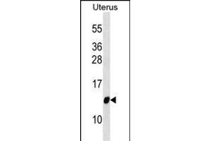 TI Antibody (Center) (ABIN6244225 and ABIN6577376) western blot analysis in Uterus tissue lysates (35 μg/lane). (TIMM10 抗体  (AA 21-49))