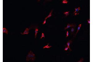 ABIN6266700 staining HeLa cells by IF/ICC. (MID1 抗体  (N-Term))
