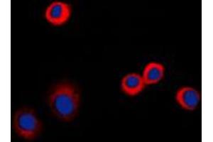 Immunofluorescence (IF) image for anti-Tumor Necrosis Factor Receptor Superfamily, Member 1B (TNFRSF1B) (C-Term) antibody (ABIN7297172)