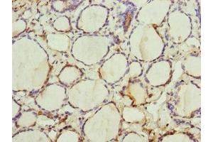 Immunohistochemistry of paraffin-embedded human thyroid tissue using ABIN7151252 at dilution of 1:100 (TRIM23 抗体  (AA 1-280))