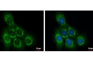 ICC/IF Image OCRL antibody detects OCRL protein at cytoplasm by immunofluorescent analysis. (OCRL 抗体  (C-Term))