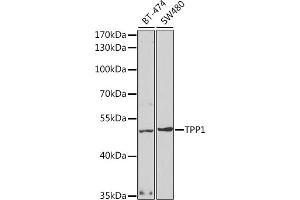 Western blot analysis of extracts of various cell lines, using TPP1 antibody (ABIN6127693, ABIN6149442, ABIN6149443 and ABIN6221263) at 1:1000 dilution. (TPP1 抗体  (AA 284-563))