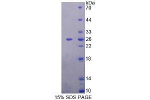SDS-PAGE analysis of Rat MTUS1 Protein. (MTUS1 蛋白)