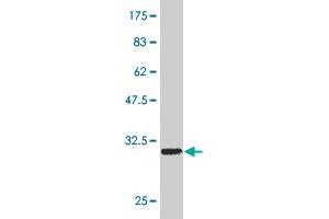 Western Blot detection against Immunogen (34. (SMAD5 抗体  (AA 105-182))