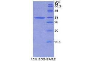 SDS-PAGE (SDS) image for Calpain 1 (CAPN1) (AA 426-676) protein (His tag) (ABIN1877993)