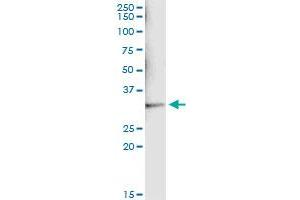 Immunoprecipitation of SULT1A1 transfected lysate using anti-SULT1A1 monoclonal antibody and Protein A Magnetic Bead , and immunoblotted with SULT1A1 monoclonal antibody. (SULT1A1 抗体  (AA 1-295))