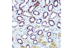 Immunohistochemistry of paraffin-embedded rat kidney using COX5B Rabbit pAb (ABIN3016355, ABIN3016356, ABIN3016357 and ABIN6219733) at dilution of 1:100 (40x lens). (COX5B 抗体  (AA 32-129))