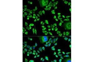 Immunofluorescence analysis of HeLa cells using CSTA Polyclonal Antibody (CSTA 抗体)