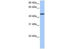 WB Suggested Anti-SAMD14 Antibody Titration: 0. (SAMD14 抗体  (N-Term))