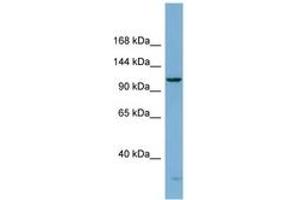Image no. 1 for anti-DEAH (Asp-Glu-Ala-His) Box Polypeptide 15 (DHX15) (AA 107-156) antibody (ABIN6741862) (DHX15 抗体  (AA 107-156))