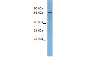 WB Suggested Anti-NDUFS1 Antibody Titration: 0. (NDUFS1 抗体  (Middle Region))