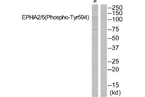 Western blot analysis of extracts from JK cells, using EPHA2/5 (Phospho-Tyr594) Antibody. (EPHA2/5 (pTyr594) 抗体)