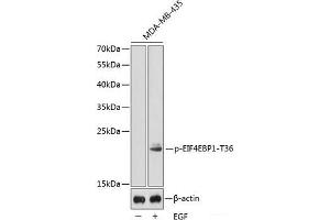 Western blot analysis of extracts from MDA-MB-435 cells using Phospho-EIF4EBP1(T36) Polyclonal Antibody. (eIF4EBP1 抗体  (pThr36))