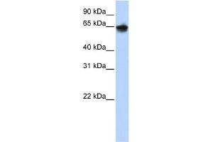WB Suggested Anti-KRT1 Antibody  Titration: 1 ug/ml Positive Control: 293T cells lysate (Cytokeratin 1 抗体  (Middle Region))