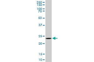 UCHL3 monoclonal antibody (M01), clone 4E9. (UCHL3 抗体  (AA 131-230))