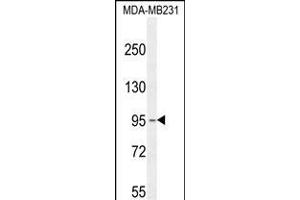 KCNT2 Antibody (C-term) (ABIN654309 and ABIN2844095) western blot analysis in MDA-M cell line lysates (35 μg/lane). (KCNT2 抗体  (C-Term))