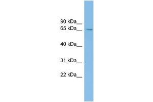 WB Suggested Anti-SLC6A1 Antibody Titration: 0. (SLC6A1 抗体  (Middle Region))