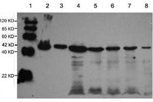 Lane 1: EasyWestern Protein Standard   Lane 2: Rabbit muscular tissue lysateLane 3: Fish tissue lysateLane 4: Cow muscular tissue lysateLane 5: Pig muscular tissue lysateLane 6: Rat brain tissue lysateLane 7: 3T3 cell lysateLane 8: Hela cell lysate Primary antibody: 1 µg/mL Rabbit Anti-alpha-Actin-1 Polyclonal Antibody (ABIN398560) Secondary antibody: Goat Anti-Rabbit IgG (H&L) [HRP] Polyclonal Antibody (ABIN398323, 1: 10,000) (Actin 抗体)