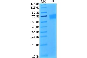 Biotinylated Human IL-17R alpha on Tris-Bis PAGE under reduced condition. (IL17RA Protein (His-Avi Tag,Biotin))