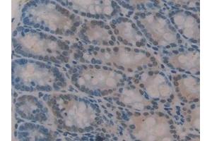 Detection of GLI3 in Mouse Colon Tissue using Polyclonal Antibody to GLI Family Zinc Finger Protein 3 (GLI3) (GLI Family Zinc Finger Protein 3 (AA 303-561) 抗体)