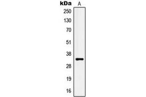 Western blot analysis of Kallikrein 3 expression in LNCaP (A) whole cell lysates. (Prostate Specific Antigen 抗体  (Center))