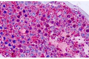 Immunohistochemistry (IHC) image for anti-Cadherin EGF LAG Seven Pass G-Type Receptor 1 (CELSR1) (C-Term) antibody (ABIN1048425)