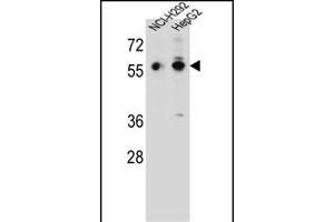 TRIM64 Antibody (C-term) (ABIN657217 and ABIN2837912) western blot analysis in NCI-,HepG2 cell line lysates (35 μg/lane). (TRIM64 抗体  (C-Term))