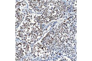 IHC analysis of SF3A1 using anti-SF3A1 antibody (ABIN7600556). (SF3A1 抗体  (AA 20-556))