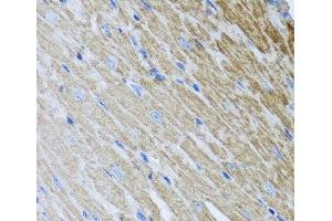 Immunohistochemistry of paraffin-embedded Mouse heart using MTX2 Polyclonal Antibody at dilution of 1:100 (40x lens). (MTX2 抗体)