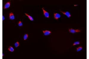 IF analysis of Peroxiredoxin 3 using anti-Peroxiredoxin 3 antibody (ABIN3043904).