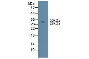 Detection of NME6 in Rat Spleen Tissue using Polyclonal Antibody to Non Metastatic Cells 6, Protein Expressed In (NME6) (NME6 抗体  (AA 1-173))