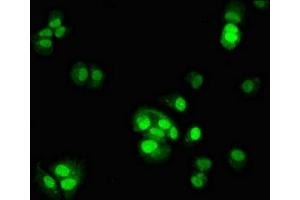 Immunofluorescent analysis of MCF-7 cells using ABIN7164202 at dilution of 1:100 and Alexa Fluor 488-congugated AffiniPure Goat Anti-Rabbit IgG(H+L) (TSR2 抗体  (AA 1-191))