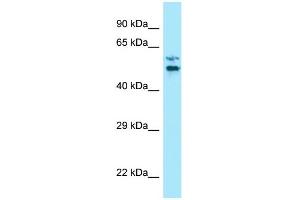 WB Suggested Anti-LTV1 Antibody Titration: 1. (LTV1 抗体  (C-Term))