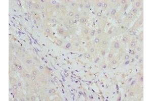 Immunohistochemistry of paraffin-embedded human liver tissue using ABIN7154996 at dilution of 1:100 (HBZ 抗体  (AA 1-142))
