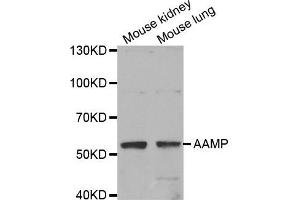 Western Blotting (WB) image for anti-Angio-Associated, Migratory Cell Protein (AAMP) antibody (ABIN1875463) (AAMP 抗体)