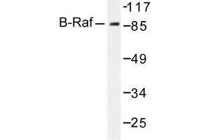 Image no. 2 for anti-B-Raf proto-oncogene, serine/threonine kinase (BRAF) antibody (ABIN271999) (BRAF 抗体)