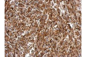 IHC-P Image Immunohistochemical analysis of paraffin-embedded RT2 xenograft, using AGR3, antibody at 1:500 dilution.