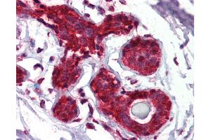 Immunohistochemistry (IHC) image for anti-Eukaryotic Translation Initiation Factor 4E Binding Protein 1 (EIF4EBP1) (AA 101-118) antibody (ABIN462434)