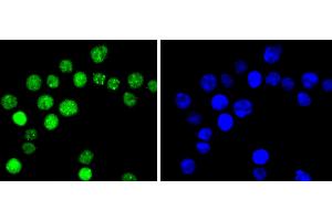 SW480 cells were stained with Cyclin E1(T77) (4G10 ) Monoclonal Antibody  at [1:200] incubated overnight at 4C, followed by secondary antibody incubation, DAPI staining of the nuclei and detection. (Cyclin E1 抗体  (pThr77))