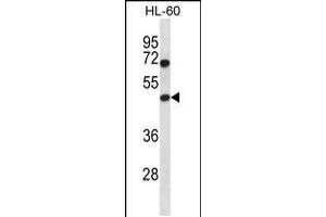 Western blot analysis in HL-60 cell line lysates (35ug/lane). (HAT1 抗体  (N-Term))