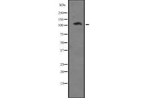 Western blot analysis of EIF4G2 expression in A431 whole cell lysate ,The lane on the left is treated with the antigen-specific peptide. (EIF4G2 抗体  (N-Term))