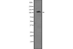 Western blot analysis of EIF4G2 expression in A431 whole cell lysate ,The lane on the left is treated with the antigen-specific peptide.