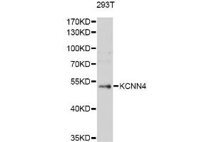 Western blot analysis of extracts of 293T cells, using KCNN4 antibody (ABIN5971024) at 1/1000 dilution.