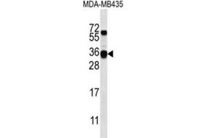 Western Blotting (WB) image for anti-Casein beta (CSN2) antibody (ABIN2996884) (CSN2 抗体)