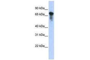 Image no. 1 for anti-Rhophilin, rho GTPase Binding Protein 1 (RHPN1) (AA 215-264) antibody (ABIN6743644) (RHPN1 抗体  (AA 215-264))