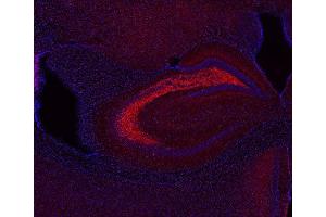 Indirect immunostaining of PFA fixed mouse brain section (dilution 1 : 200; red). (SV2C 抗体  (AA 2-16))