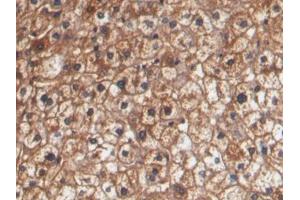 DAB staining on IHC-P; Samples: Human Liver Tissue (HPR 抗体  (AA 102-347))