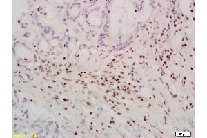 Immunohistochemistry (Paraffin-embedded Sections) (IHC (p)) image for anti-Telomerase Reverse Transcriptase (TERT) (AA 601-750) antibody (ABIN726650)