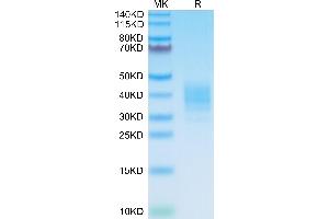 Mouse SLAMF7 on Tris-Bis PAGE under reduced condition.